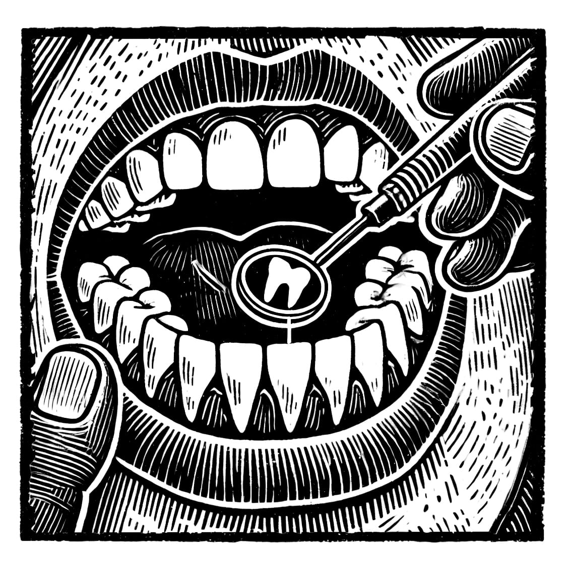Dental Treatment