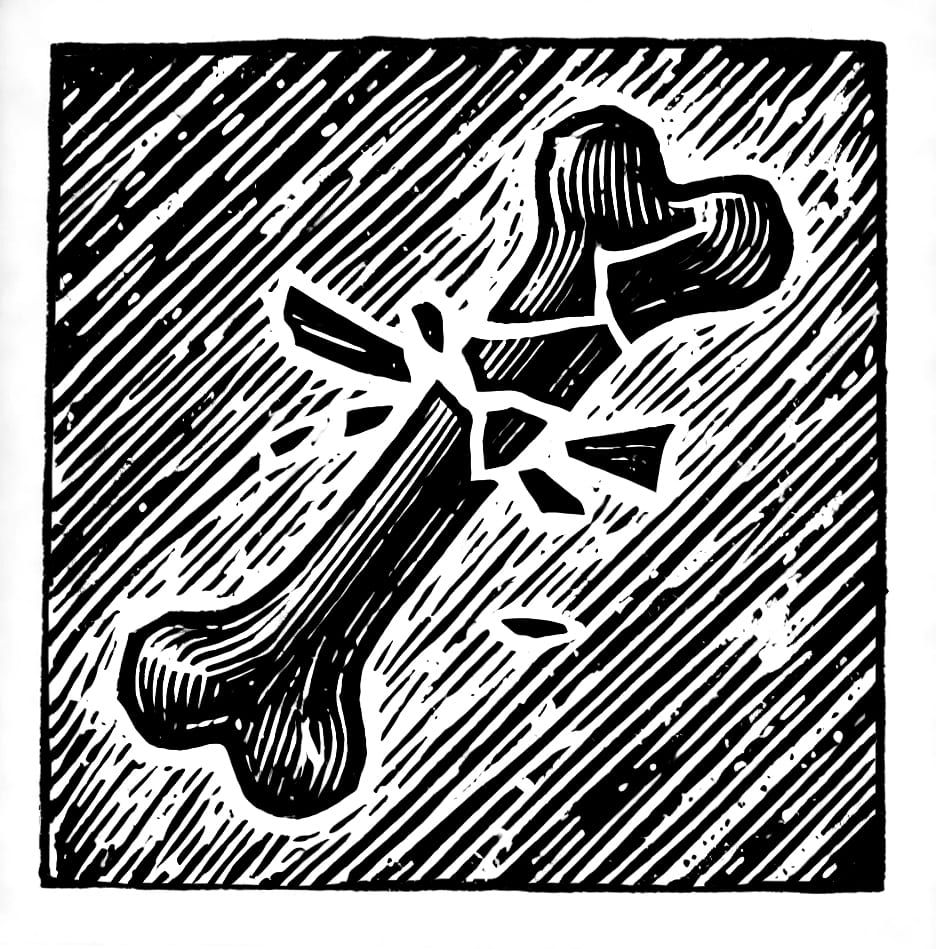 Fracture